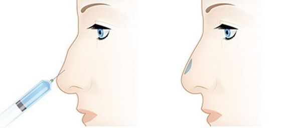 The procedure allows you to adjust various problems