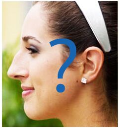 Nose deformity after rhinoplasty