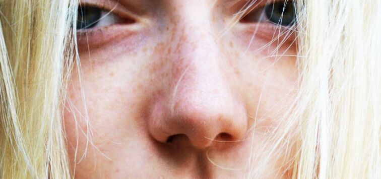 The woman's nose