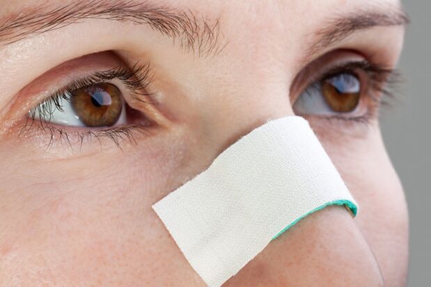 possible complications in the postoperative period of correction of the nasal septum